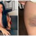 Caso da nutricionista que lutou para escapar de estupro: entenda a cronologia e as dúvidas da investigação